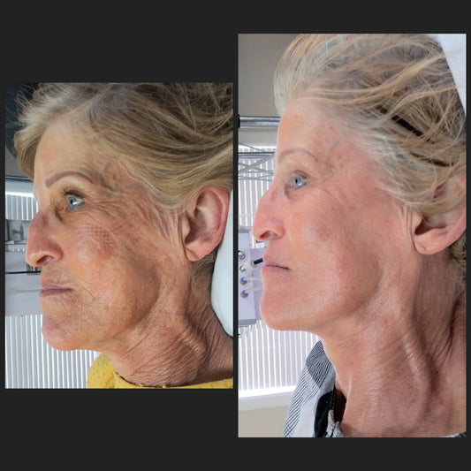 Anti Aging Gift Box Trio